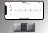 Oc AliveCor ķɑЫ@߶헌oЧ